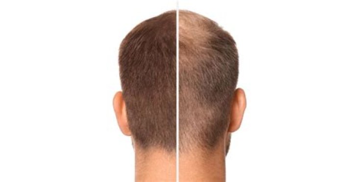 Does omega3 help hair?